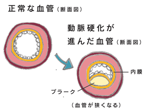 血管の変化