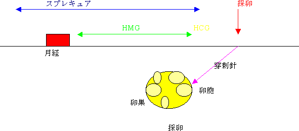 long法の図